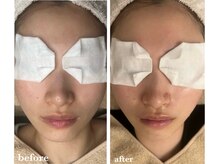 サロン ド ラム/【PDTコース】3回目