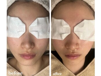 サロン ド ラム/【PDTコース】3回目