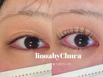 リノア バイ チュラ(linoa by Chura)/before/after