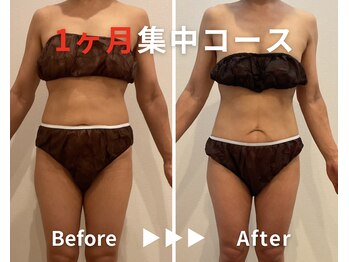 エピデリ 福岡大濠(EPI de RIZ)/【痩身/ダイエット】1ヶ月集中