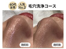 グラツィア(Grazia)/毛穴クリア洗浄コース