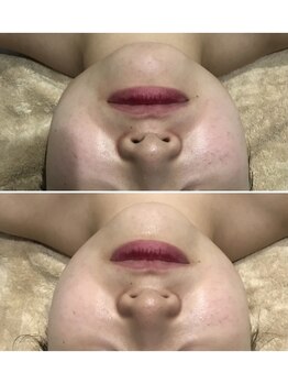 イチ(ICHI)/札幌/大通/ハーブ/インディバ