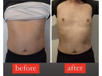 シェイプアップサロン/【Before&After】