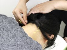 ノモコツ鍼灸院 ワンズモール千葉稲毛院(NOMOKOTSU鍼灸院)の雰囲気（痛み、だるさ、しびれ等のお身体の不調も鍼施術で幅広く対応◎）