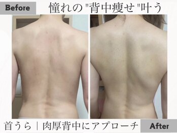 ヨサパーク 美世(YOSA PARK bize)/気がついたら、背面美人も叶う