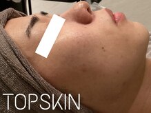 トップスキン 新宿(TOPSKIN)/ハーブ専門STAFFが担当します◎