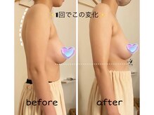 ラファ(Rapha)/バストアップ＆姿勢改善！