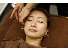 とまり木鍼灸整骨院 北青山院/経験ある美容鍼を受けれます