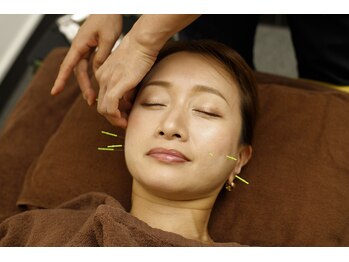 とまり木鍼灸整骨院 北青山院/経験ある美容鍼を受けれます