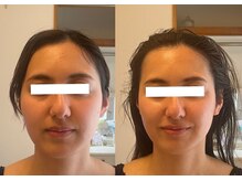 ルポ 那覇(repos)/電気美容鍼70分