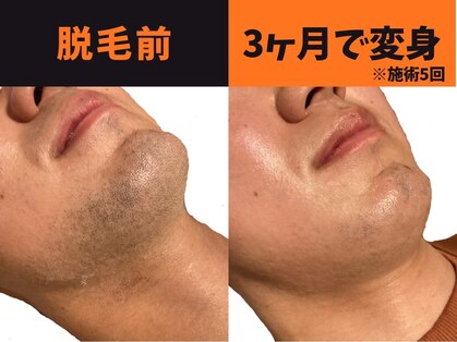 モイ(moi)の写真