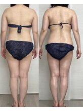 ヨルエステ(yoru aesthe)/【姿勢矯正、月1～total 7回目】