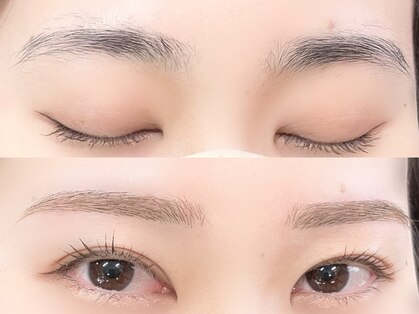 フレックル(freckle)の写真
