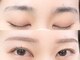 フレックル(freckle)の写真