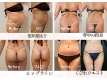 ラ ルーチェ 星田の雰囲気（脂肪燃焼コース12回★全体的に引き締まりスッキリ！）