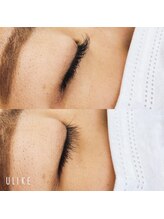 ウイシャンス(ui chance)/アップワードラッシュ