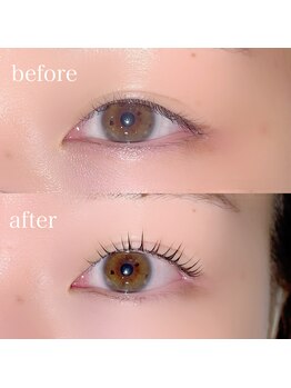 トリコ 調布(TRICO)/バターロッド