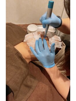 リジューブ(Rejuve)/リゼネレート