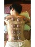 【背中から首・肩こりを解消☆】ハーブコース＋カッピング 120分　13,500円