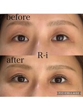 アールアイ(R-i)/アイリッドアップパーマ