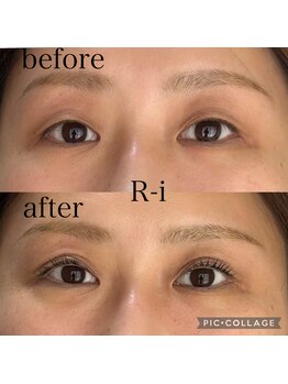 アールアイ(R-i)/アイリッドアップパーマ