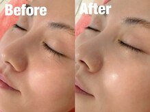 ビーキュート 渋谷北参道店(BE-CUTE)/リフトアップトリートメント