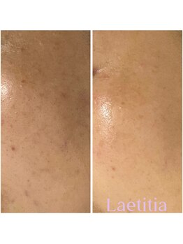 レティティア(Laetitia)/セラピール&光フォト4回目