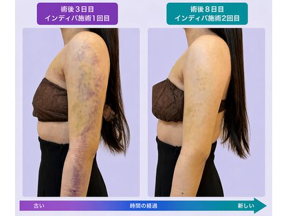 ミモ(MIMO)の写真