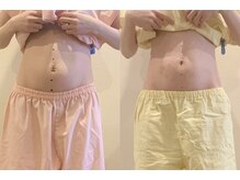 アカシア鍼灸整骨院の雰囲気（カウンセリング充実◎【痩身鍼灸】健康的に美しく★）