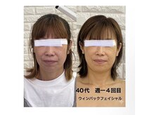 エステサロン クレイドルフェザーの雰囲気（守谷駅周辺で【劇的ビフォーアフター】小顔矯正と二の腕ケアも。）