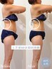 【二の腕・背中のハミ肉ケア】上半身集中痩身2回体験60分 通常価格¥52,800→