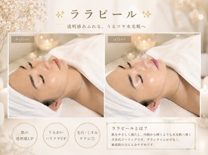 ビジュー(BIJOU)の写真