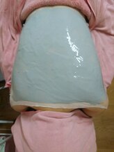 ユーアンドミー(You&Me)/背中美白ケア