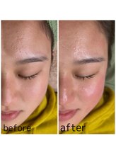 リモレア(RemoLe'a)/艶肌WAX