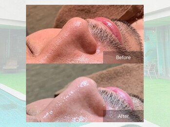 ベルゼ 渋谷店(BELZE)/男性×毛穴洗浄♪