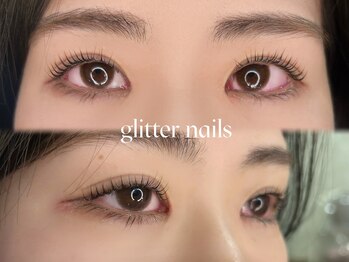 グリッターネイル(GLITTER NAILS)/【KOKONE担当】セラムラッシュ