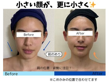 お顔の研究所/ビフォーアフター写真♪