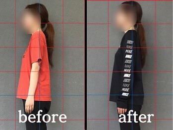 ヴレ 福岡店(Vraie)/ピラティスで猫背、巻き肩解消!