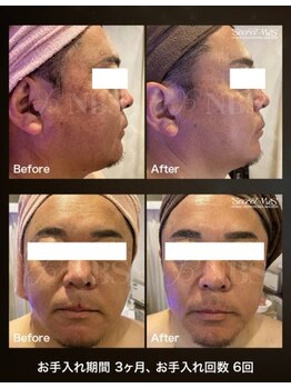 もみほぐし 西浦和店/《男性専用》清潔感UP！