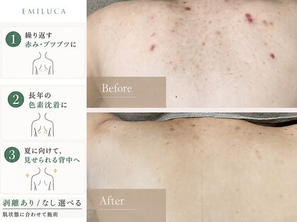 エミルカ 天王寺店(EMILUCA)の写真