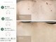 エミルカ 天王寺店(EMILUCA)の写真