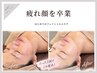 【フェイシャル】疲れ顔を卒業！イキイキとした明るいお肌へ！