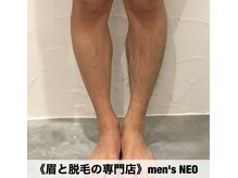 メンズネオ 長崎店(men's NEO)/清潔感アップ足脱毛