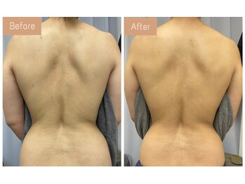 FJ/今年こそダイエット卒!