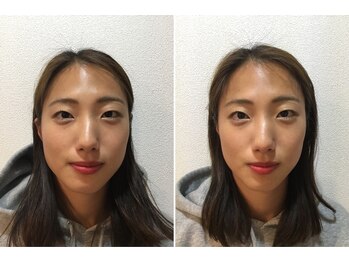 西日暮里整体院/小顔整体ビフォーアフター★