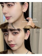 アンユー(an.u)/ケラチンラッシュリフト/耳ツボ