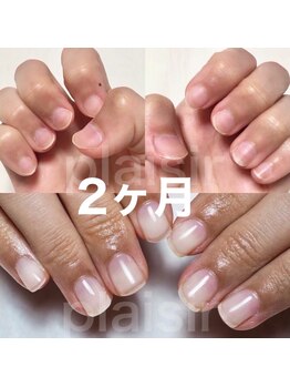 マリーシーオー(MARY-CO.)/深爪矯正