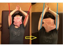 アポセオシス 目黒駅前(apotheosis)/肩や首周りのお悩み改善コース◎