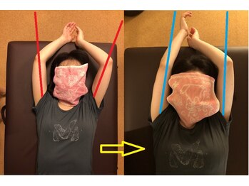 アポセオシス 目黒駅前(apotheosis)/肩や首周りのお悩み改善コース◎