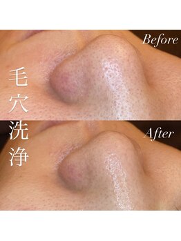 アース コアフュールボーテ 上越店(EARTH coiffure beaute)/毛穴洗浄